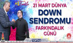 Başkan Toptaş’tan 21 Mart Dünya Down Sendromu farkındalık günü mesajı